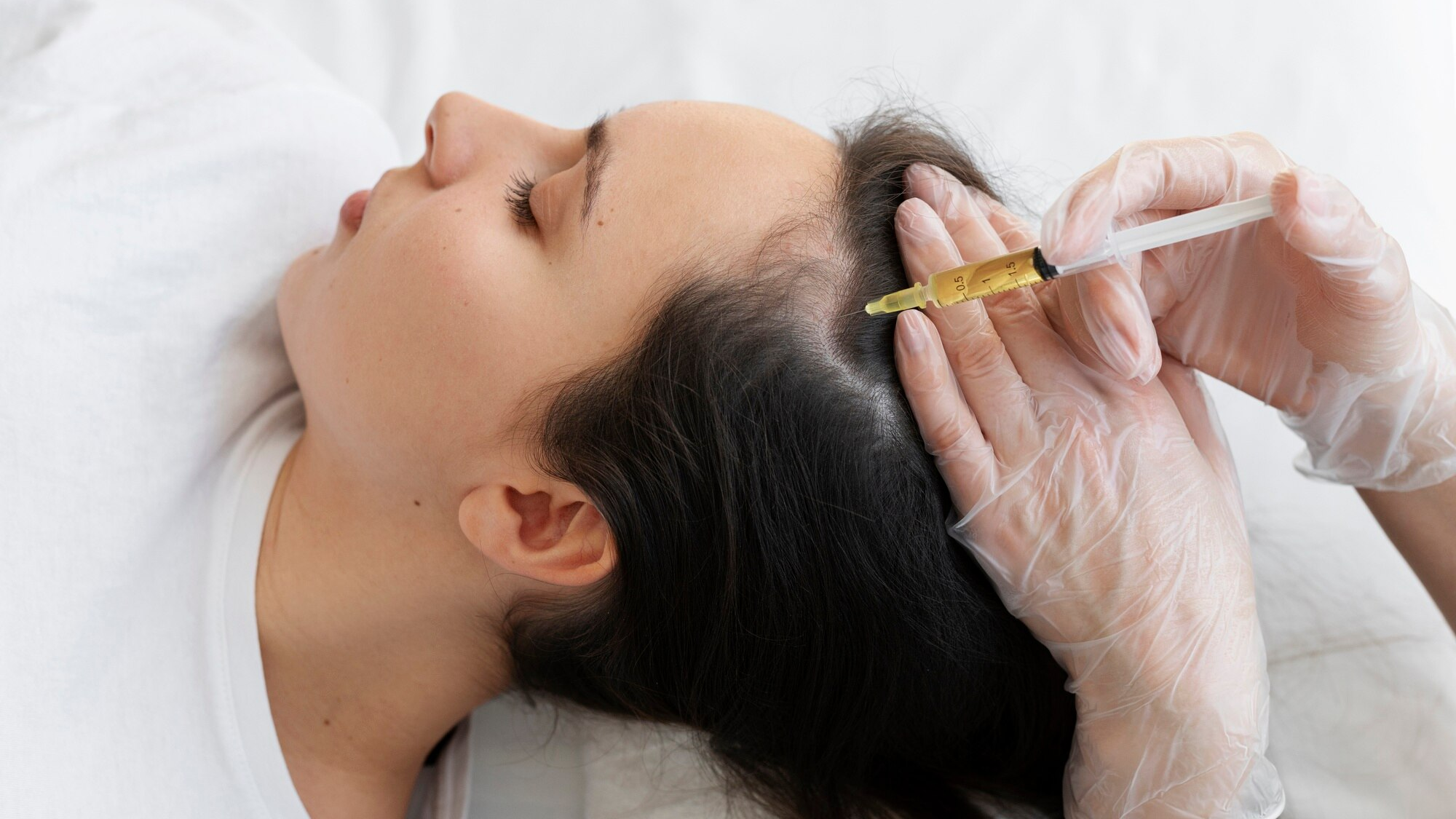 Mesotherapy