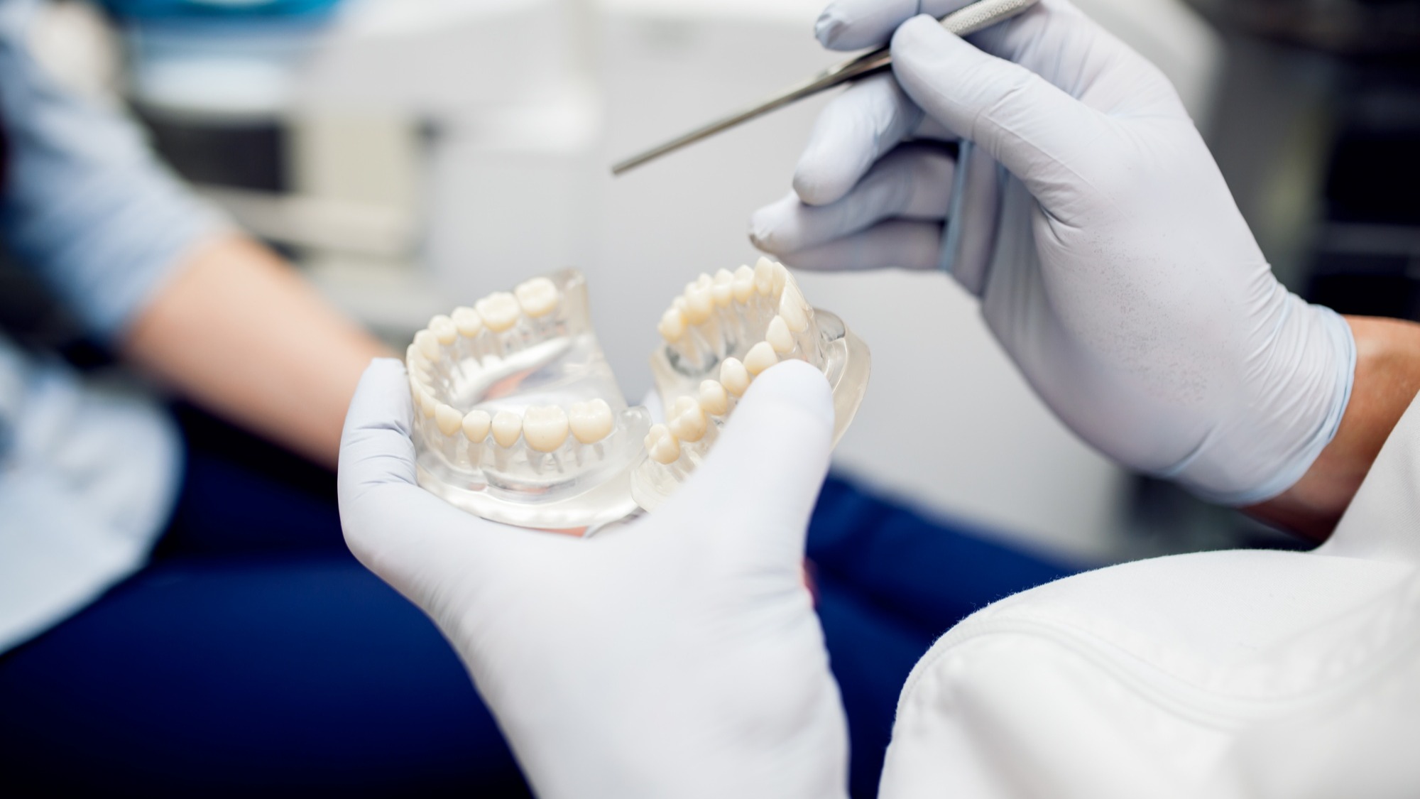 Dental Crowns