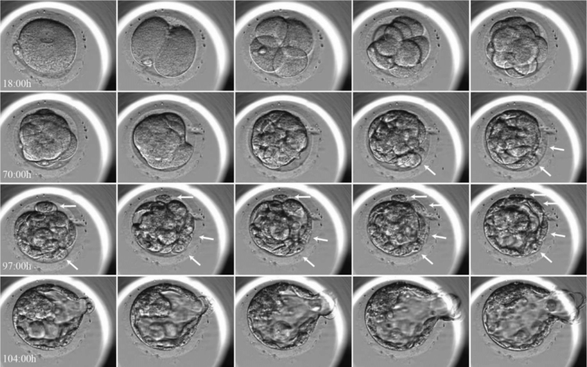 Embryoscope (CEMM)